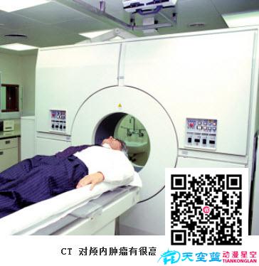 CT能檢查什么??？.jpg