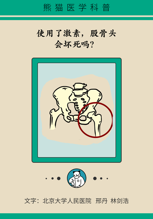激素會帶來股骨頭壞死的后遺癥嗎？