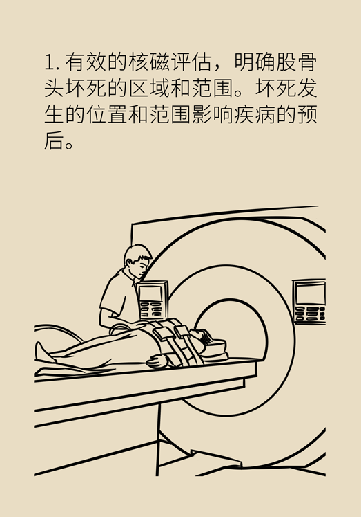 激素會帶來股骨頭壞死的后遺癥嗎？