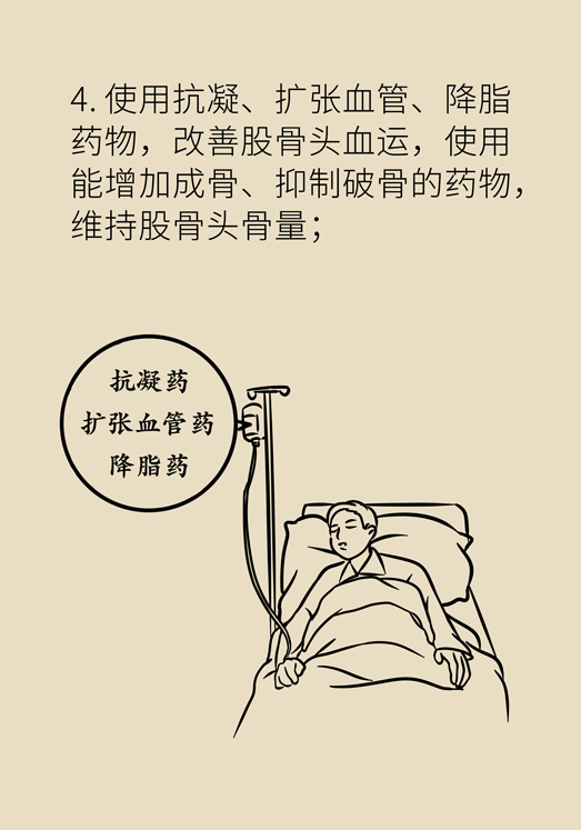 激素會帶來股骨頭壞死的后遺癥嗎？