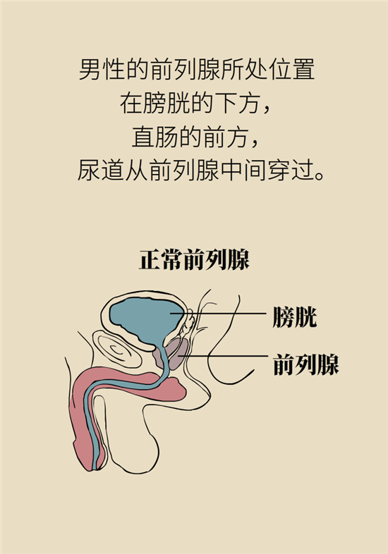 前列腺肥大了還能縮小嗎？