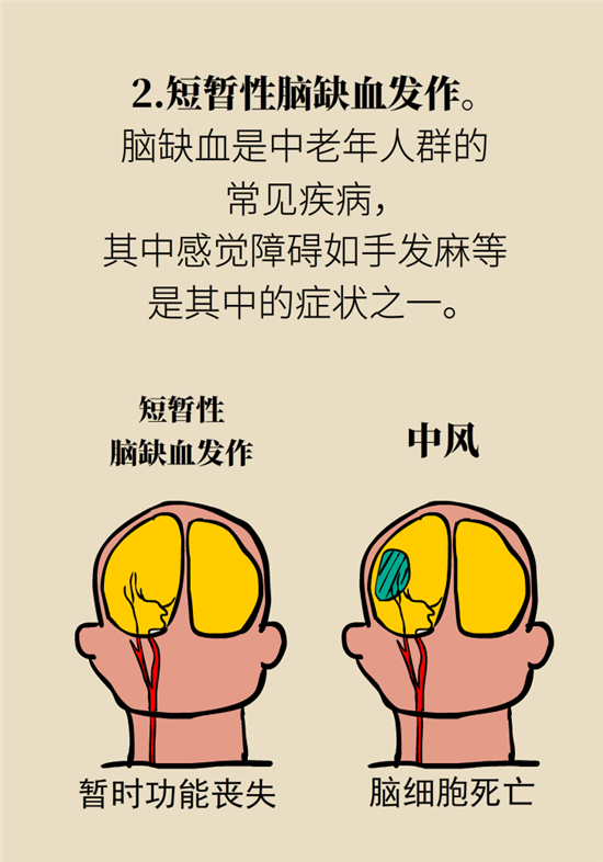無(wú)緣無(wú)故的手麻，這是身體發(fā)出的什么信號(hào)？