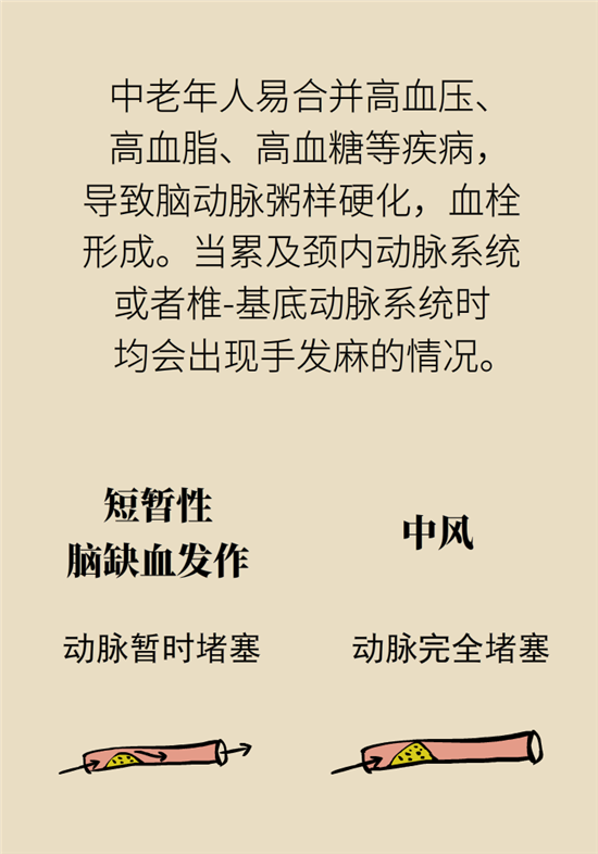 無(wú)緣無(wú)故的手麻，這是身體發(fā)出的什么信號(hào)？