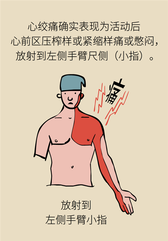 什么是冠心病，這些疼痛可能是心絞痛！