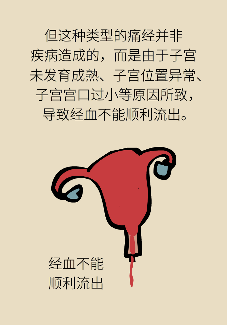 生孩子后痛經(jīng)會消失，是真的嗎？