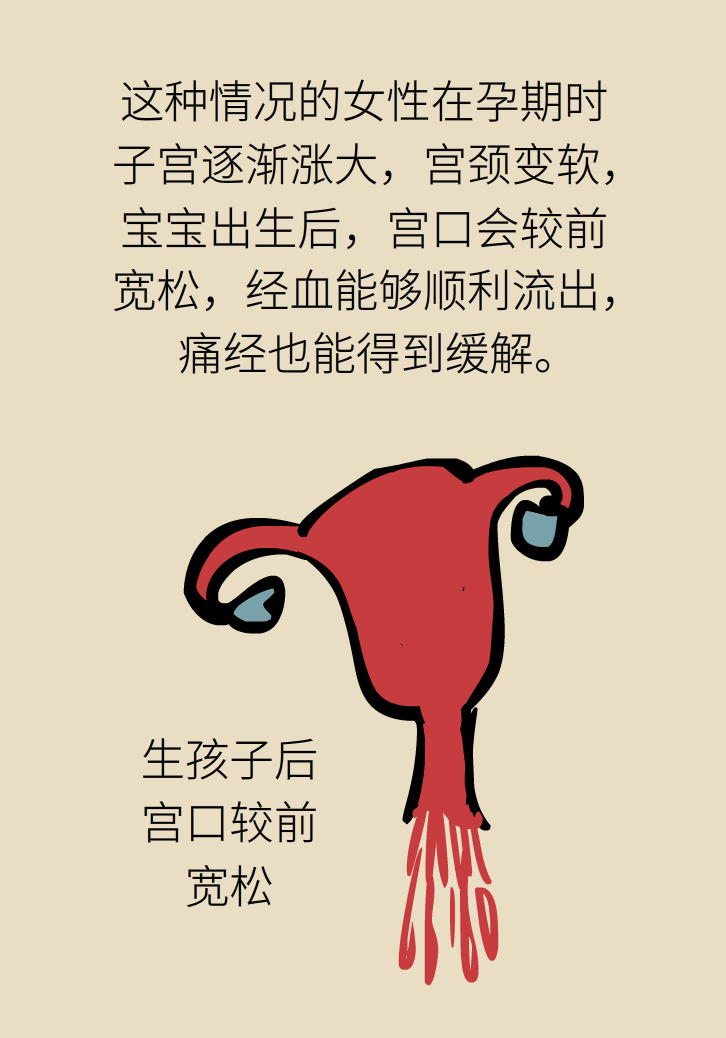 生孩子后痛經(jīng)會消失，是真的嗎？