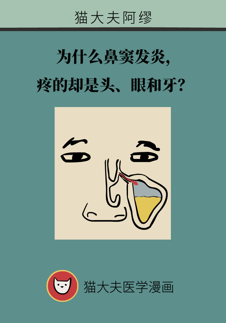 為什么鼻竇發(fā)炎，疼的卻是頭、眼和牙？
