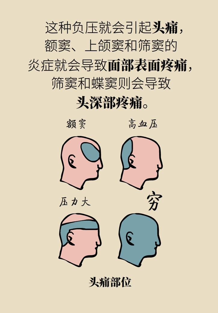為什么鼻竇發(fā)炎，疼的卻是頭、眼和牙？
