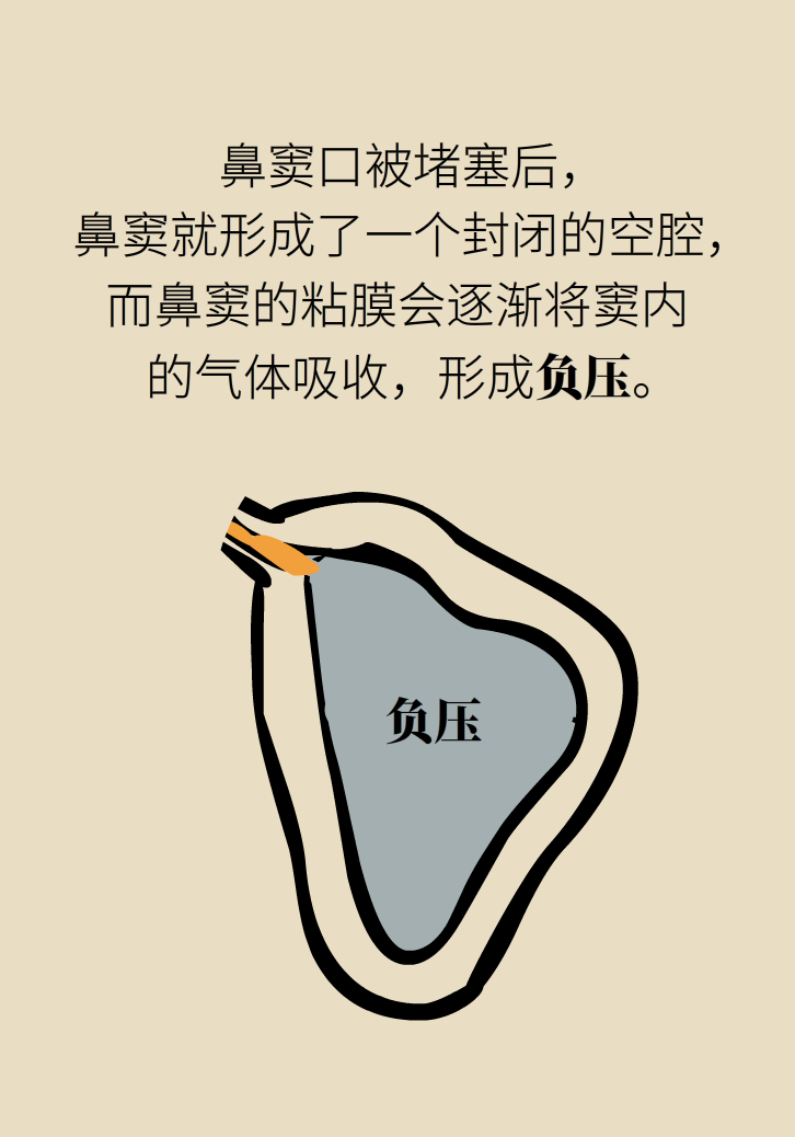 為什么鼻竇發(fā)炎，疼的卻是頭、眼和牙？
