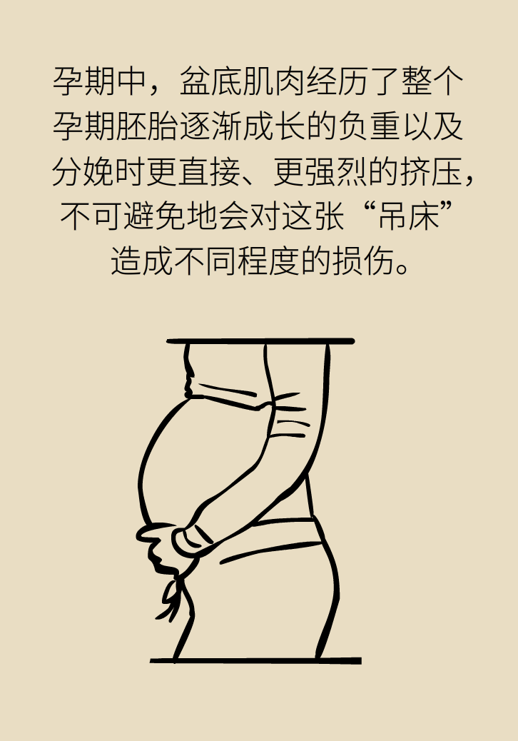 選擇剖腹產(chǎn)，就能避免盆底肌損傷嗎？