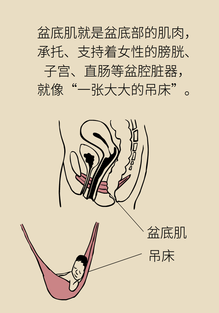 選擇剖腹產(chǎn)，就能避免盆底肌損傷嗎？