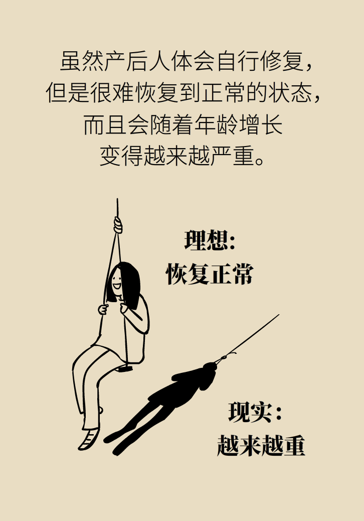 選擇剖腹產(chǎn)，就能避免盆底肌損傷嗎？