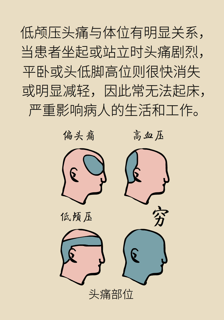 練瑜伽把腦脊液拉漏了！常見的“瑜伽病”你知道多少