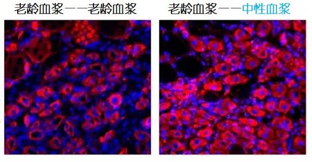 重返年輕不用大換血，只要給血液“兌點水”？