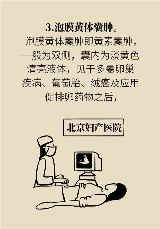 卵巢囊腫科普動(dòng)漫：卵巢囊腫是腫瘤嗎？要學(xué)會(huì)這樣區(qū)分