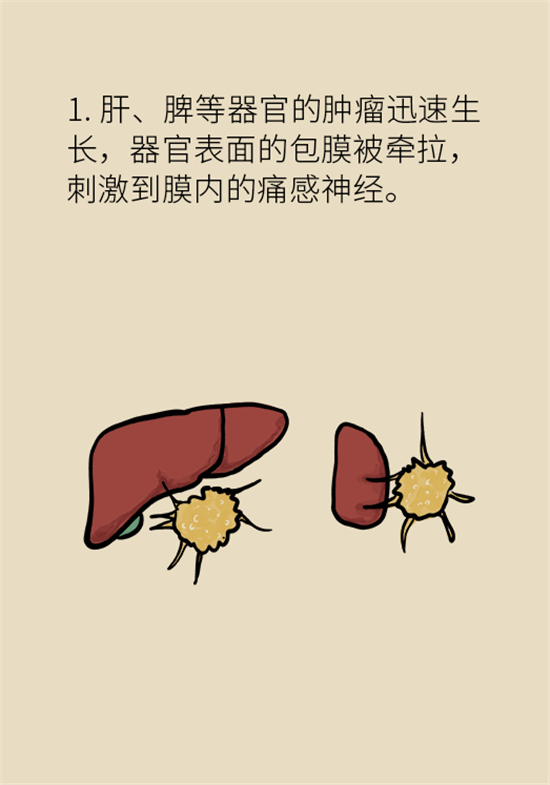 癌癥到底有多痛？需要注意這7個(gè)重點(diǎn)問(wèn)題