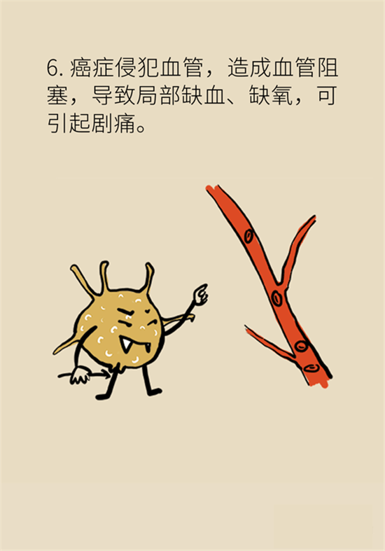 癌癥到底有多痛？需要注意這7個(gè)重點(diǎn)問(wèn)題