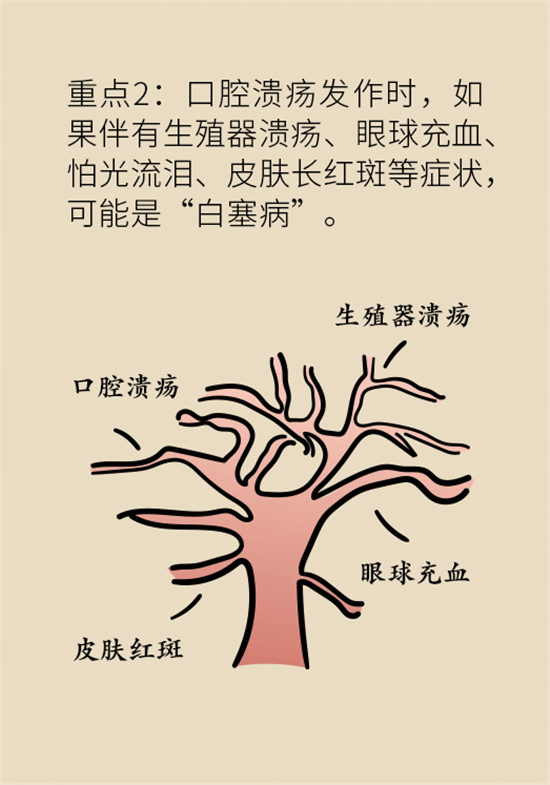 口腔潰瘍還想約火鍋？這四種情況一定要高度警惕