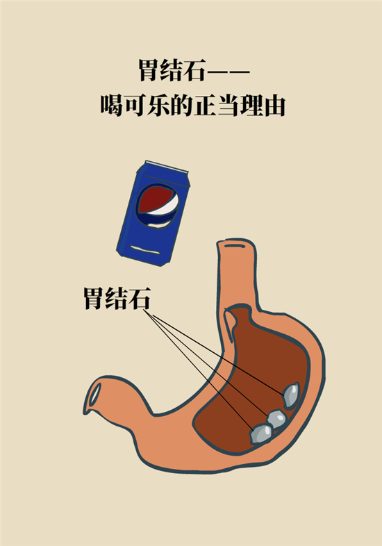 結(jié)石科普：身體里多了各種結(jié)石，應該怎么辦？