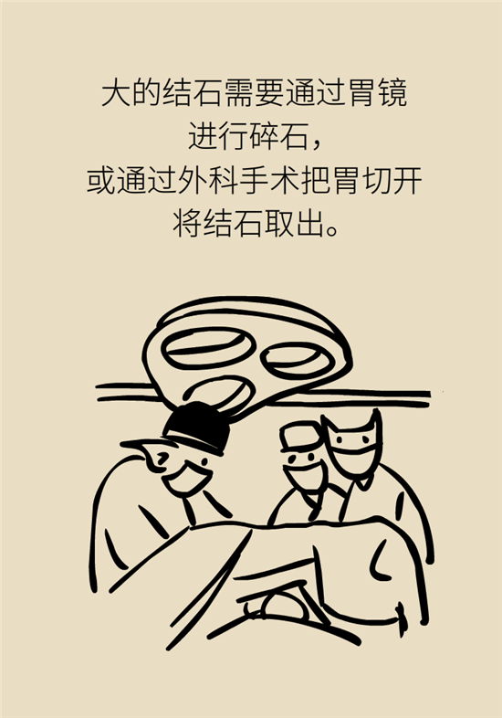 結(jié)石科普：身體里多了各種結(jié)石，應該怎么辦？