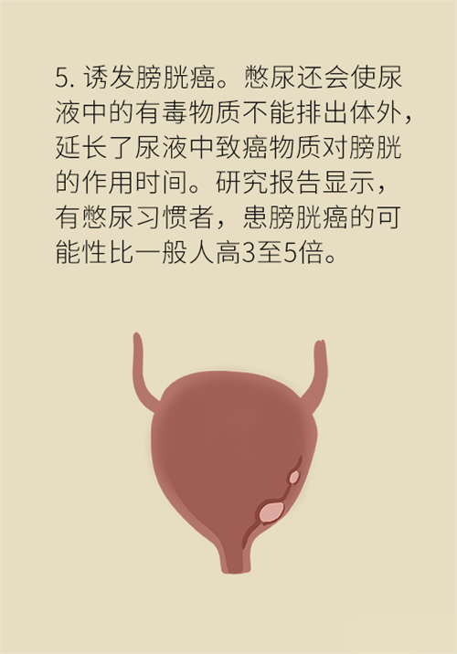 憋尿的7大危害，你真的了解嗎？