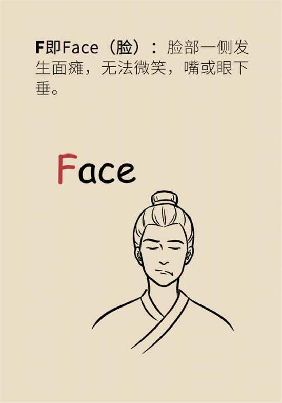 年紀(jì)輕輕別大意，小心腦卒中