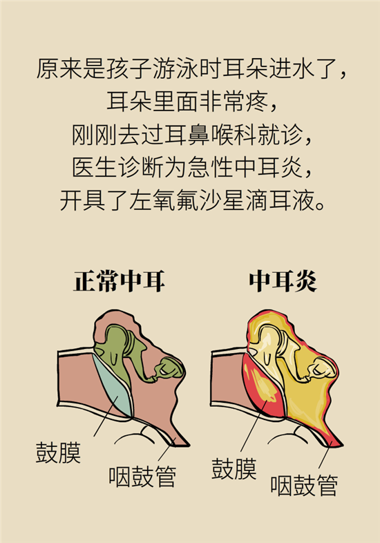 孩子游泳耳朵進水用“耳浴“？得注意這7大細節(jié)