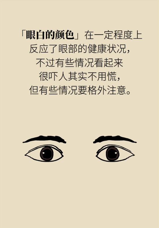 眼白有斑塊、出血要緊嗎？專(zhuān)家：名字唬人但問(wèn)題不大