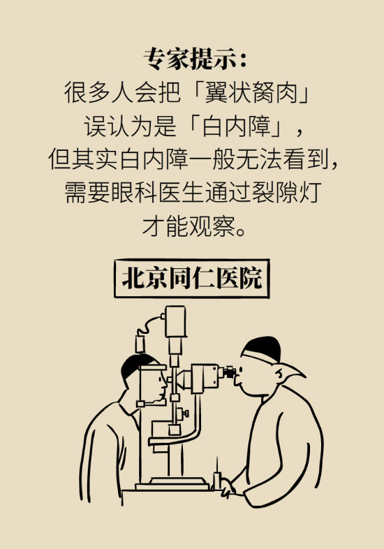 眼白有斑塊、出血要緊嗎？專(zhuān)家：名字唬人但問(wèn)題不大