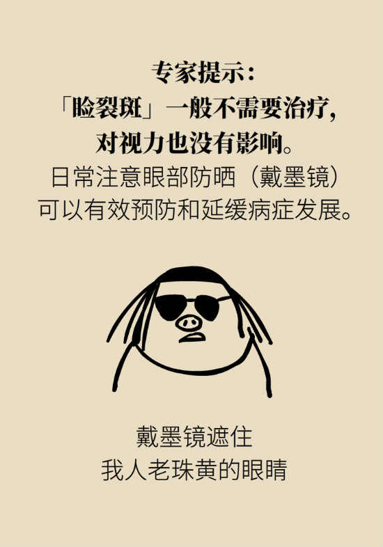 眼白有斑塊、出血要緊嗎？專(zhuān)家：名字唬人但問(wèn)題不大