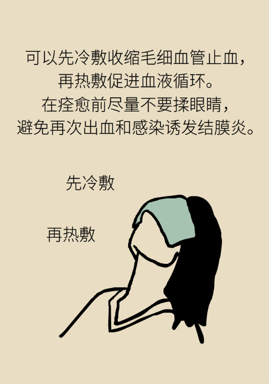 眼白有斑塊、出血要緊嗎？專(zhuān)家：名字唬人但問(wèn)題不大