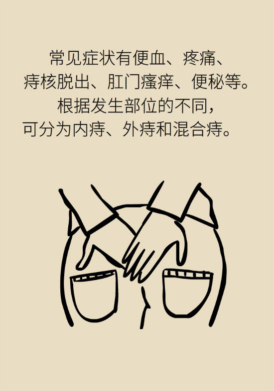長“痔”如何久安？專家的建議來了