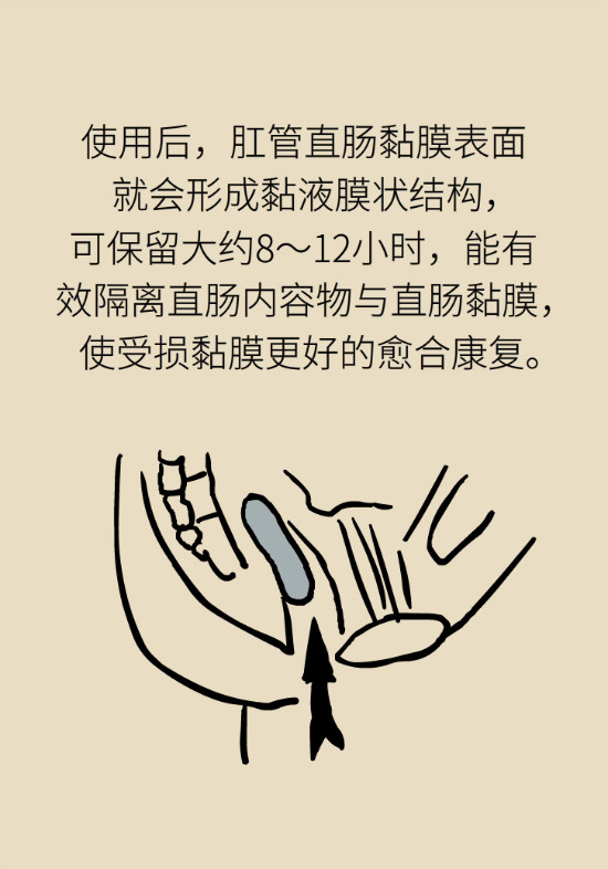 長“痔”如何久安？專家的建議來了