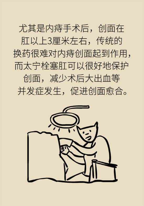 長“痔”如何久安？專家的建議來了