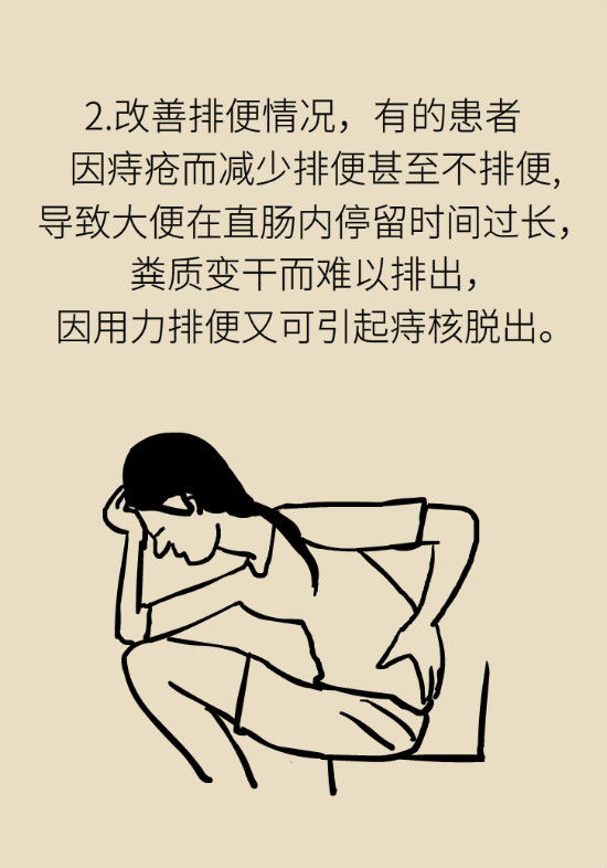 長“痔”如何久安？專家的建議來了