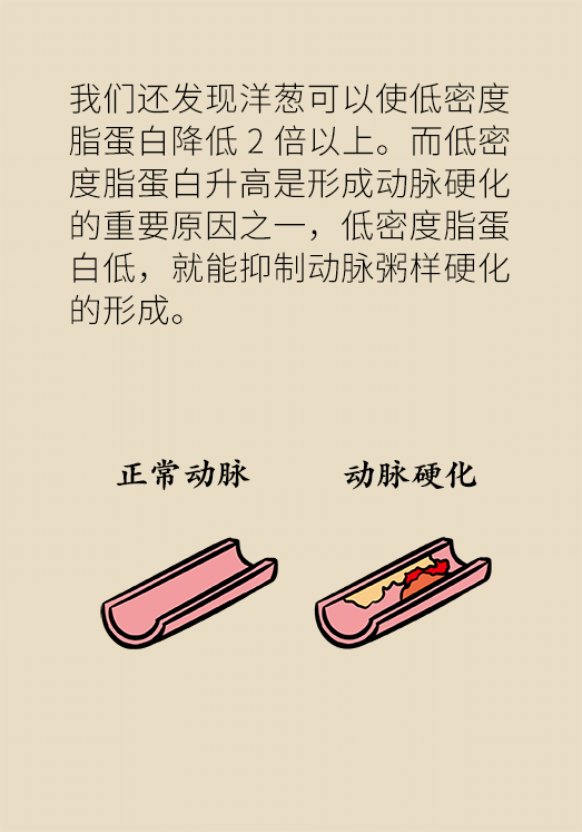 洋蔥可以預(yù)防動脈硬化，是真的嗎？