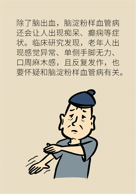 身體出現(xiàn)這些癥狀要小心，可能是腦出血發(fā)出的信號(hào)