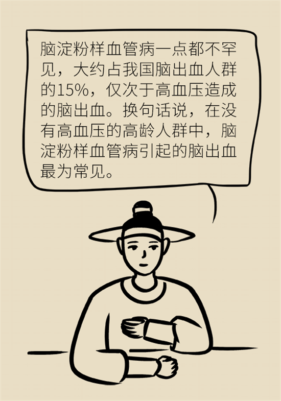 身體出現(xiàn)這些癥狀要小心，可能是腦出血發(fā)出的信號(hào)