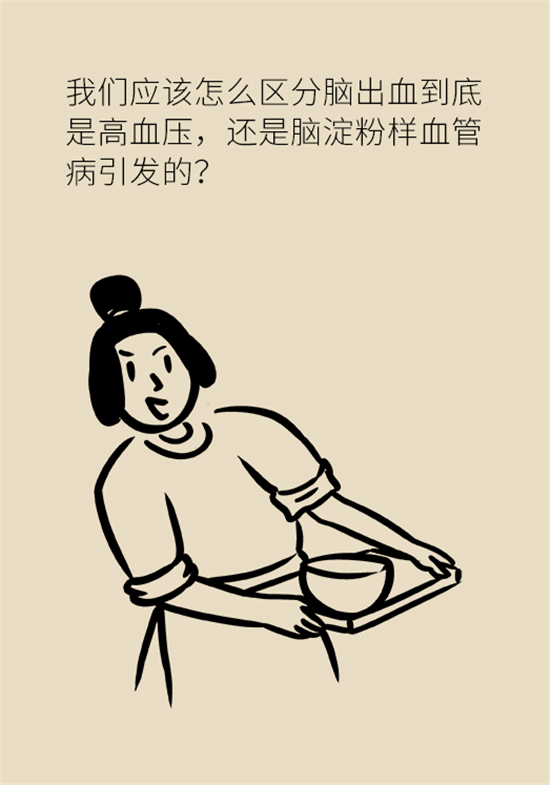 身體出現(xiàn)這些癥狀要小心，可能是腦出血發(fā)出的信號(hào)