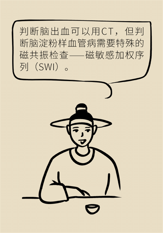 身體出現(xiàn)這些癥狀要小心，可能是腦出血發(fā)出的信號(hào)