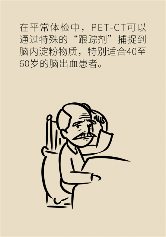 身體出現(xiàn)這些癥狀要小心，可能是腦出血發(fā)出的信號(hào)