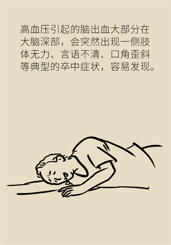 身體出現(xiàn)這些癥狀要小心，可能是腦出血發(fā)出的信號(hào)