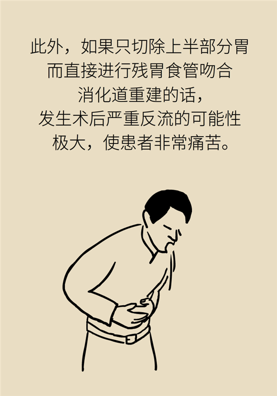 胃癌手術(shù)一定要全切胃？專(zhuān)家：視情況而定