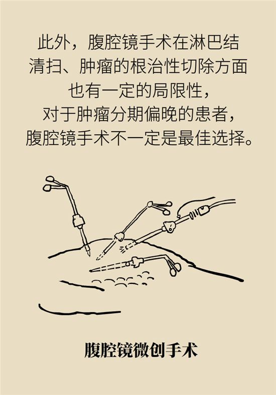 胃癌手術(shù)一定要全切胃？專(zhuān)家：視情況而定