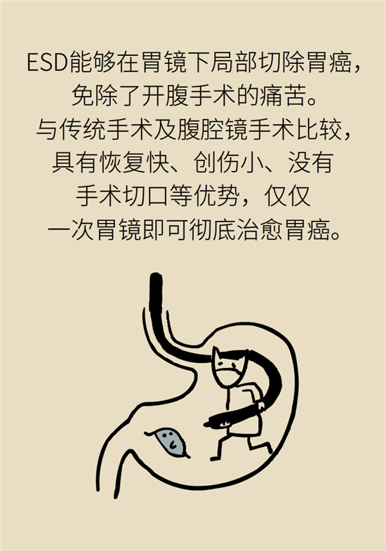 胃癌手術(shù)一定要全切胃？專(zhuān)家：視情況而定