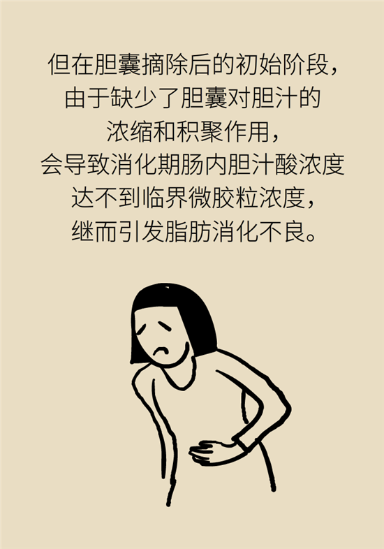 膽結(jié)石主要成分竟是膽固醇？預(yù)防它只需四個(gè)字