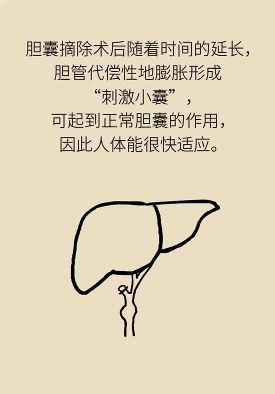 膽結(jié)石主要成分竟是膽固醇？預(yù)防它只需四個(gè)字
