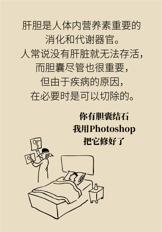 膽結(jié)石主要成分竟是膽固醇？預(yù)防它只需四個(gè)字