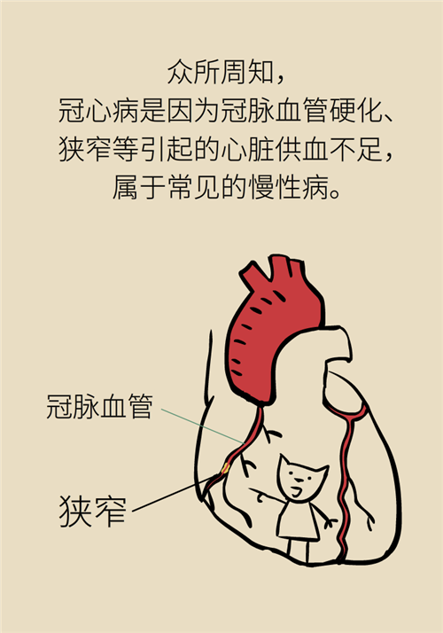 為什么裝完支架猝死風險還增高了？都是因為這些壞習慣