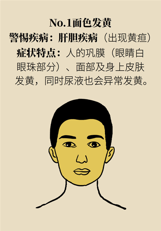 臉上的9個變化分別警示什么?。靠鞂︾R自查